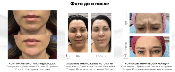 Улучшили юзабилити сайта и увеличили конверсию пользователя в клиента на 24%. Кейс